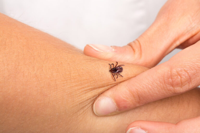 epidemiolog-predupredil-o-skrytoj-opasnosti-kleshhej-v-osennij-period-b82f2ab