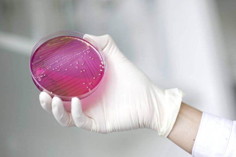 nazvany-opasnye-infekcii-obladajushhie-ustojchivostju-k-antibiotikam-1affa60